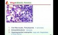 Haematology RBC Deficiency Anemias