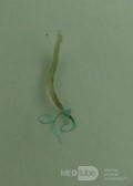 Trichuris Trichuris (whipworm) (8 of 10)