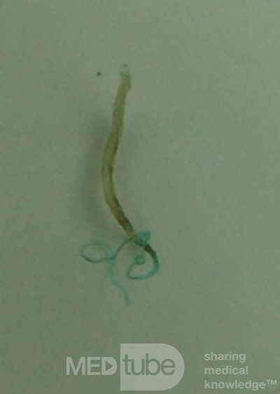 Trichuris Trichuris (whipworm) (8 of 10)