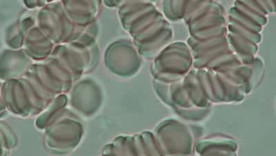 Red blood cell