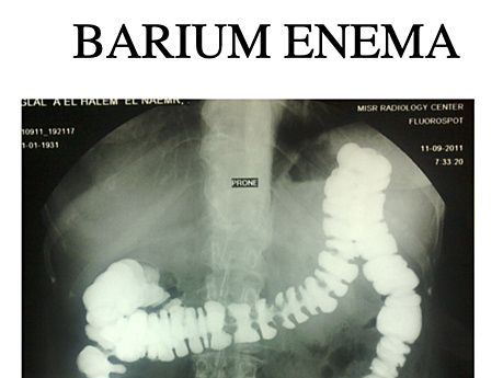 Surgical Radiology of Intestine
