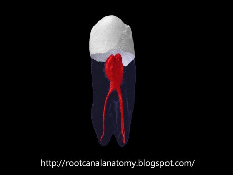 Mandibular First Premolar - Root Canal Anatomy - 3