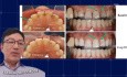 Clinical Case Discussions for Teeth Whitening ft Dr Wyman Chan (MAGIC Part 2)