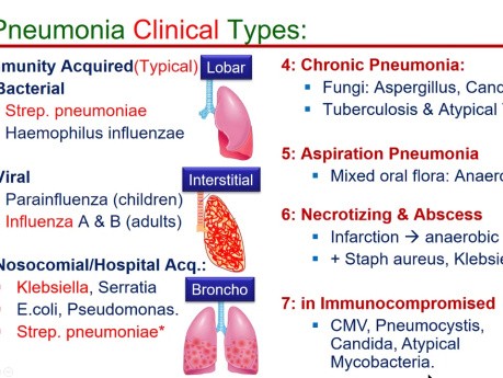 Pulmonary Infections - Pneumonia