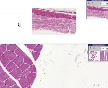 Skeletal Muscle - Atrophy