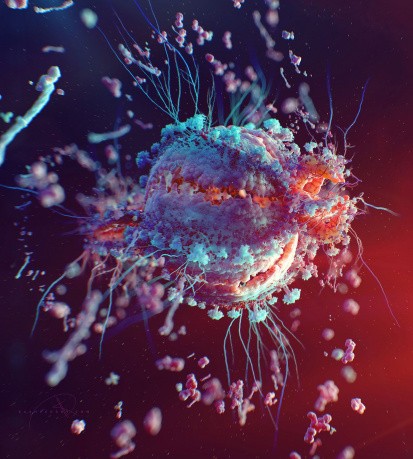 HIV - Human Immunodeficiency Virus