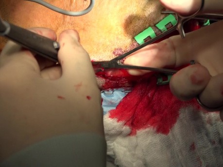 Cranial Vault, Zygoma and Maxillary Fractures Surgical Treatment