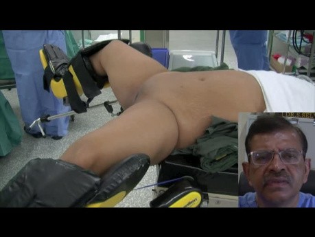 Tips and Tricks in Performing Surgery by Laparoscopy - Preparation of Patient for Laparoscopic Surgery