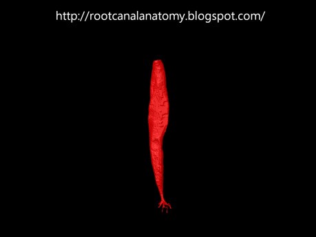 Mandibular Canine - Root Canal Anatomy