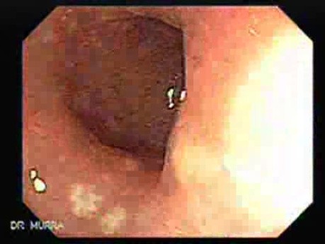 Rectum (8 of 30)