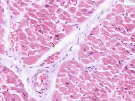 Heart Endo Peri Epi - Histology
