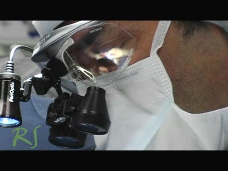 Rhinoplasty - Before And After The Nose Surgery