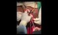 LeForte Colpocleisis (Dr Wedisha Gankanda)