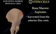 Stem Cells in Orthopaedics - Video Lecture