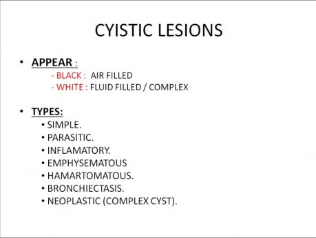 Lecture in Chest Surgery
