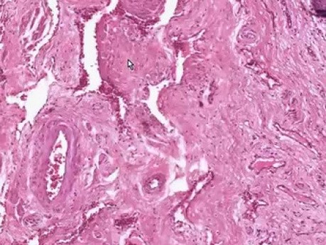 Penis - Histology