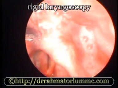 Laryngeal Injury