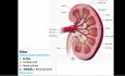 Ultrasound Renal Stone Differential Diagnosis