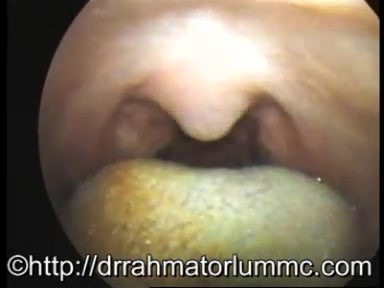 An Elevation of A Soft Palate & Uvula Contraction