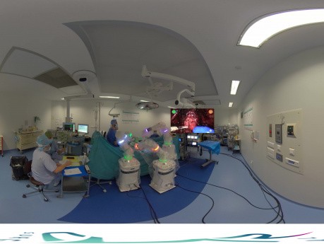 360° Versius Prostatectomy at Centre Hospitalier d'Argenteuil