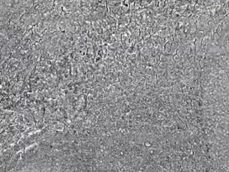 Lymph Node Reticulin Fibers - Histology