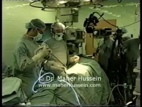 Live Surgery At AUB - Part 2