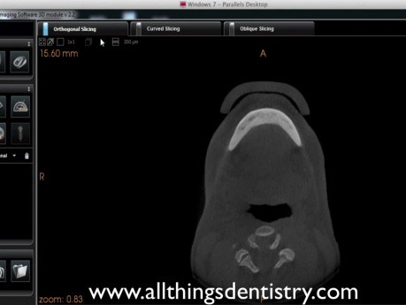 CBCT Viewing Software 101