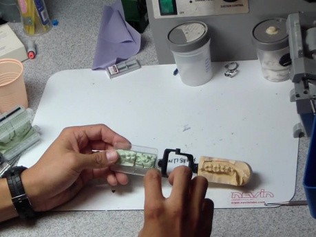 Crown Core Preparation