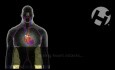 Atherosclerosis