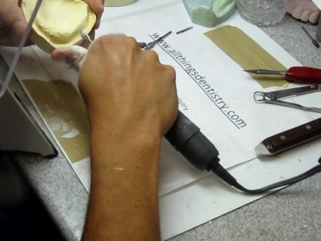 Complete Denture - Master Cast Preparation- Stone Lab Bur