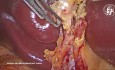 Live Anatomy Cholangiogram Duct Diagram