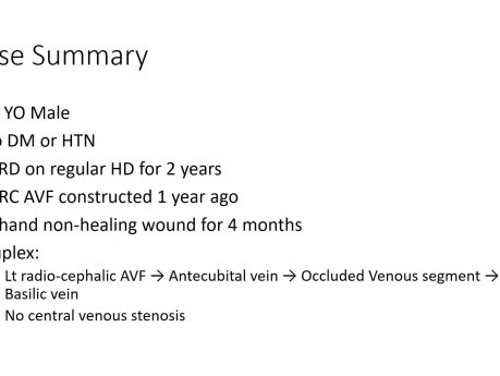 Hand Ulcer Due to an AVF Outflow Obstruction