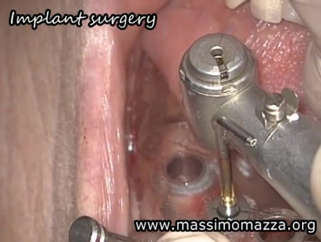 Value Of Microscopy In Dental Surgery