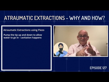 Atraumatic Extractions - Why and How?
