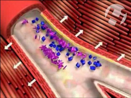 Platelet Aggregation