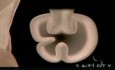 Transoral Gastroplasty (TOGA)