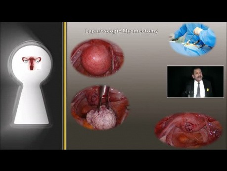 DR RK Mishra Live Stream - Introduction of Minimal Access Surgery