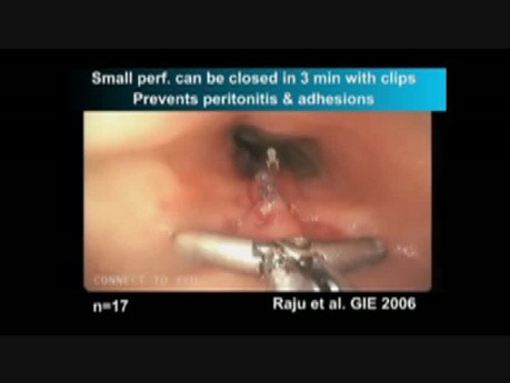 Development of Closure Techniques - Experimental Studies