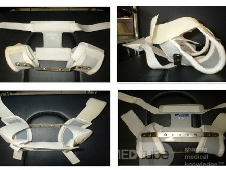 Hip Abductor Splint