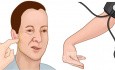 Hypocalcemia (Signs and Symptoms) - CHVOSTEK'S & TROUSSEAU SIGN.