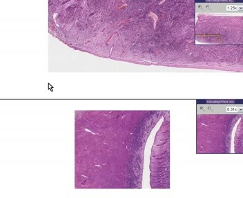 Endometrium - Senile Atrophy