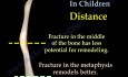 Bone healing and remodeling in children - Video Lecture