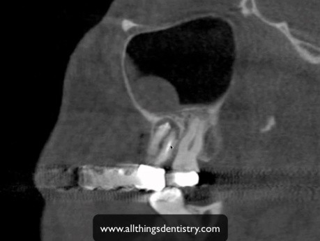 Implant Board Presentation Review - 4 Oct 11