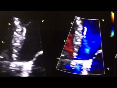 3. Echocardiography Case - What You See?
