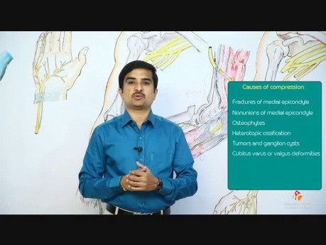 Cubital Tunnel Syndrome
