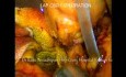 Laparoscopic CBD Exploration