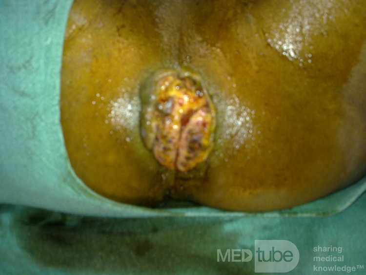 Surgical Photos