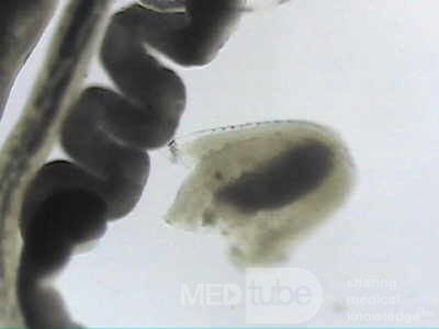 Trichuris Trichuris (whipworm) (8 of 19)