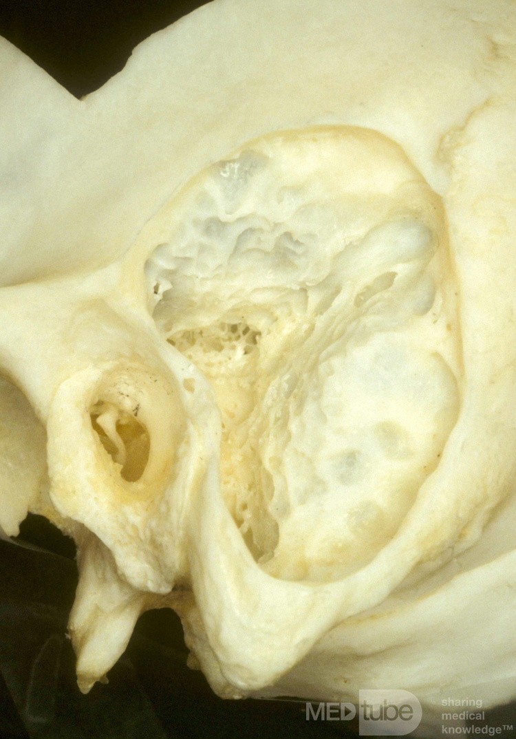 Mastoid Air Call System Anatomical Specimen