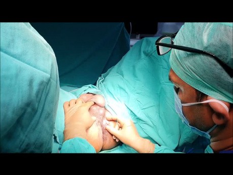 How Useful is Antibiotic Medicine for Fistula Treatment